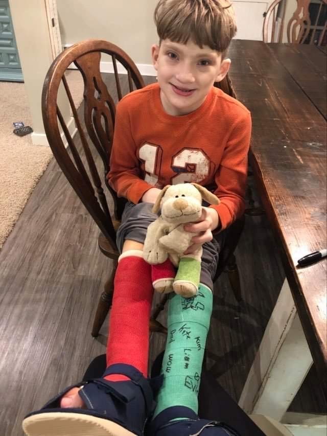 Owen with casts on his legs