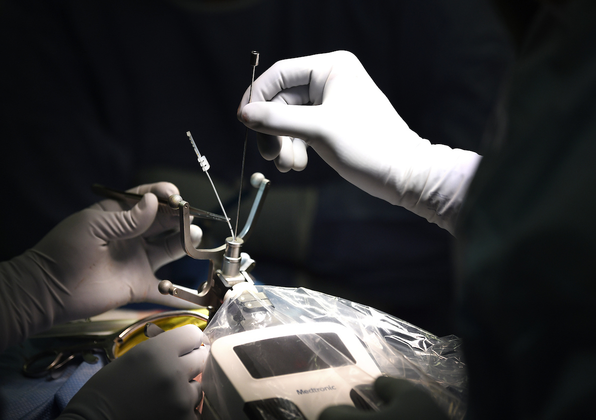 An up-close of the Autoguide cranial robotic device