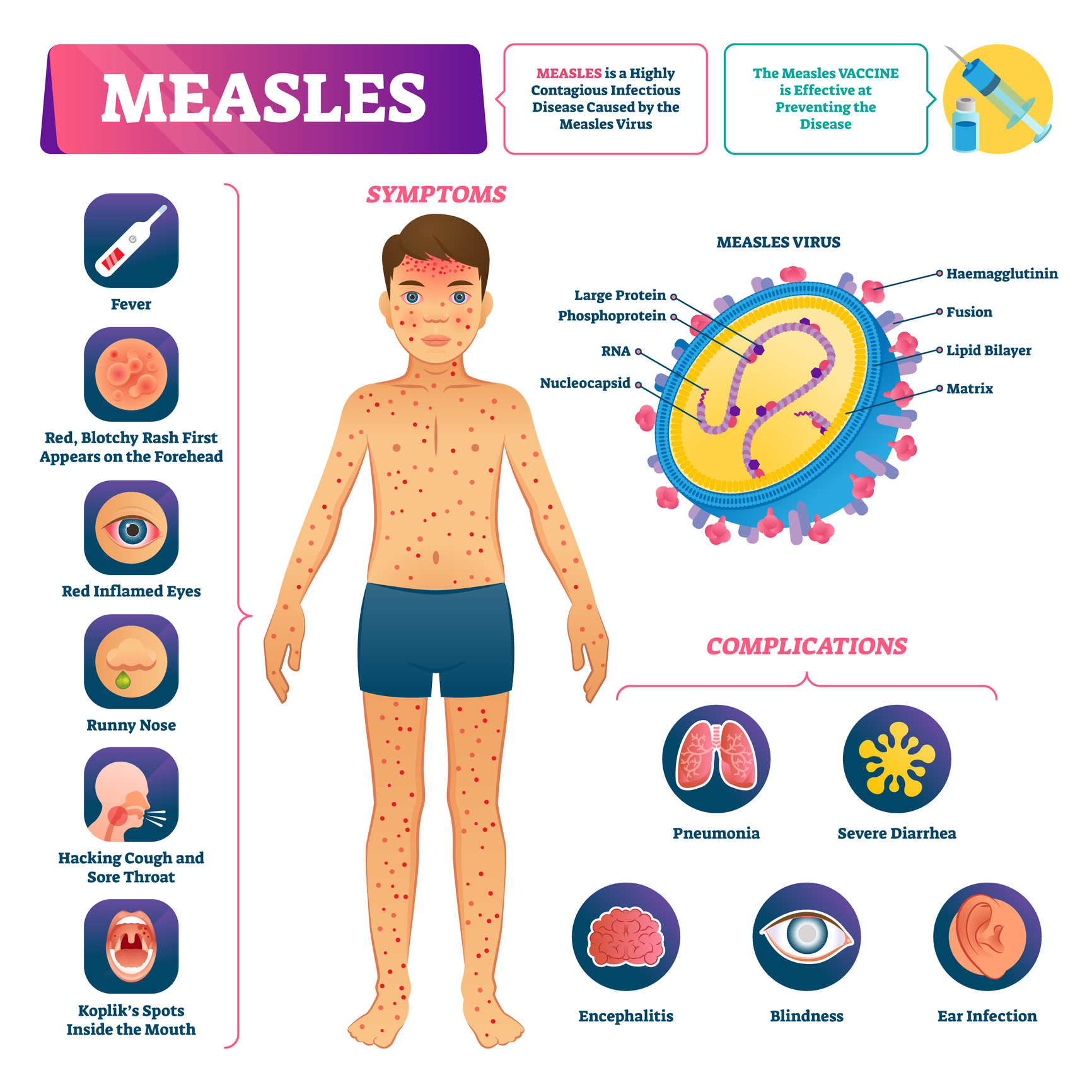 Measles