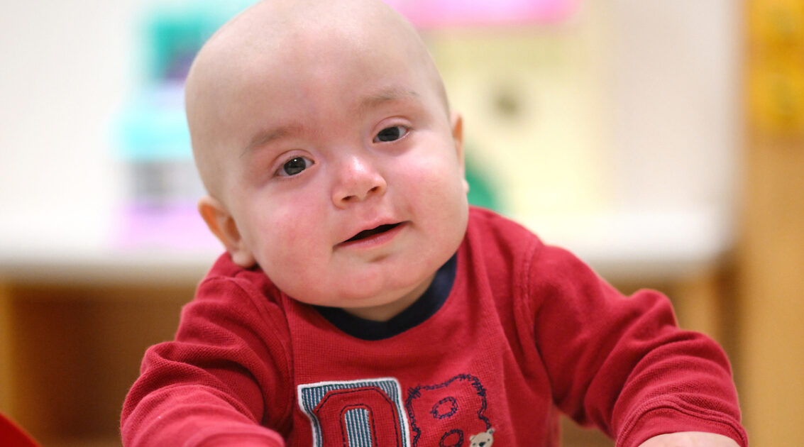 Transplant gives toddler with rare… | Riley Children's Health