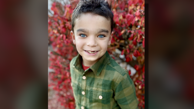 View more about Riley patient taking 'exceptionally rare' condition in stride