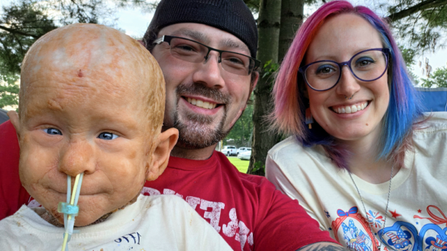 View more about Child beating the odds against extremely rare genetic condition