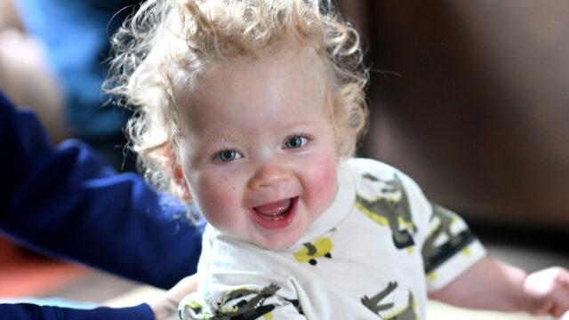 16-month-old with spina bifida makes “remarkable” progress